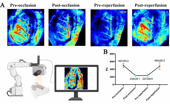 Blood flow heat maps and bar graph; pre/post occlusion-reperfusion; robotic imaging setup.