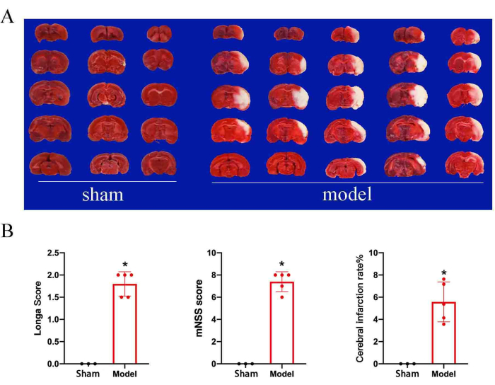 Rat brain section comparison; sham vs model. Graphs showing Longa score, mNSS, infarction rate.