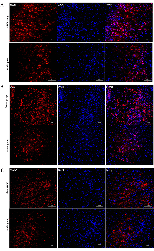 Immunofluorescence microscopy, NeuN, DCX, MAP-2 staining, DAPI counterstain, brain tissue comparison.