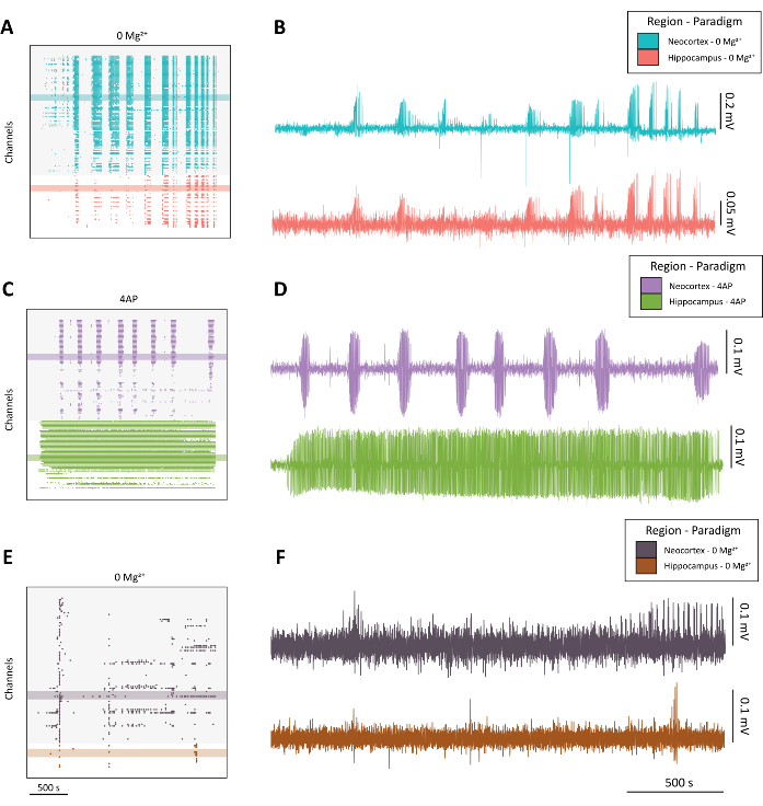 figure-protocol-4 Brain activity analysis; channel data comparison in neocortex, hippocampus; graph; 0 Mg\(^2+\), 4AP.