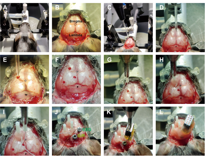 Neurosurgery procedure on rodent skull; EEG probe implantation; stereotactic setup; 12 steps.