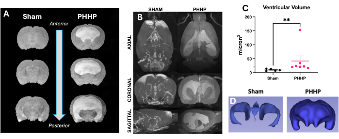 Brain MRI scans comparing Sham and PHHP groups, showing A-C axial slices, C graph, D 3D models.