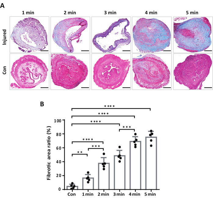 figure-results-5 Microscopy images, fibrotic tissue analysis, time series (1-5 min), histology; chart, fibrosis ratio.