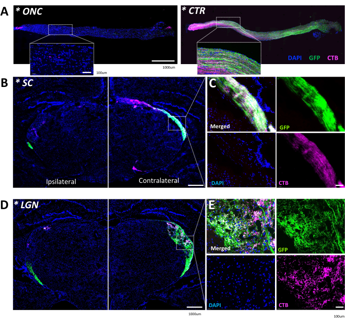 Fluorescence microscopy images of neural tissue showing DAPI, GFP, and CTB labeling in SC and LGN.