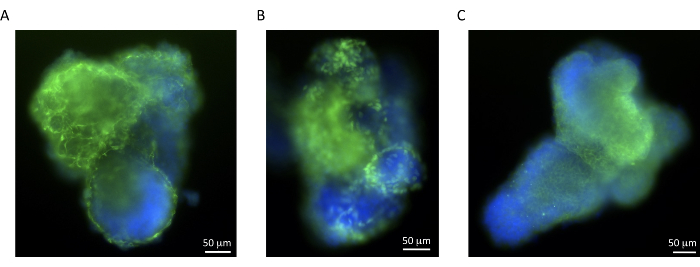 figure-results-2 Fluorescence microscopy image of cellular structures, protein localization analysis, experiment result.