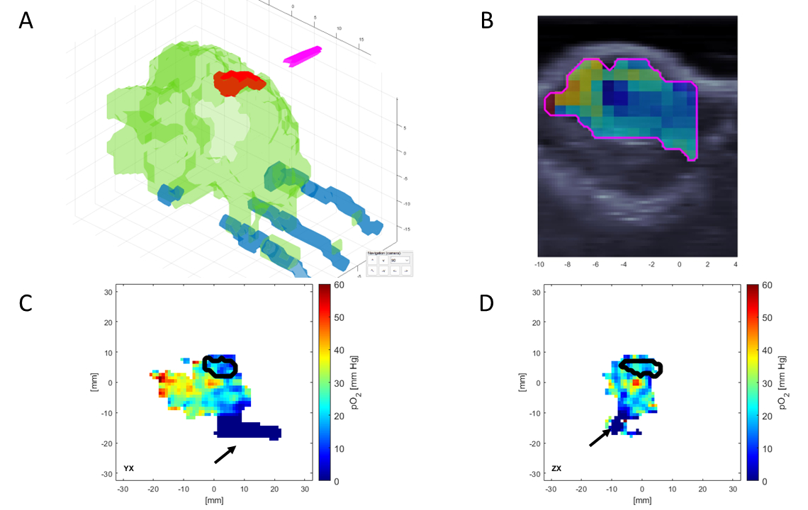 Tumor Hypoxia Assessment: In Vivo 3D Oxygen Imaging Through Electron ...