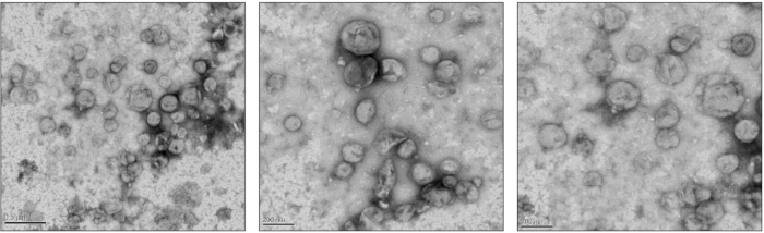 figure-results-2 Transmission electron microscopy images showing vesicle morphology and distribution in nanoscale structures.