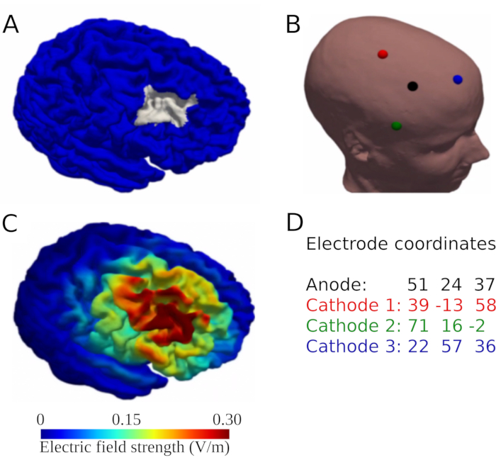 figure-results-1 Brain electric field distribution; electrode mapping; 3D model; field strength color map; coordinates.