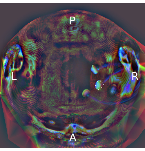 figure-results-5 MRI brain scan with labeled sections; diagram for neurological analysis and anatomical mapping.