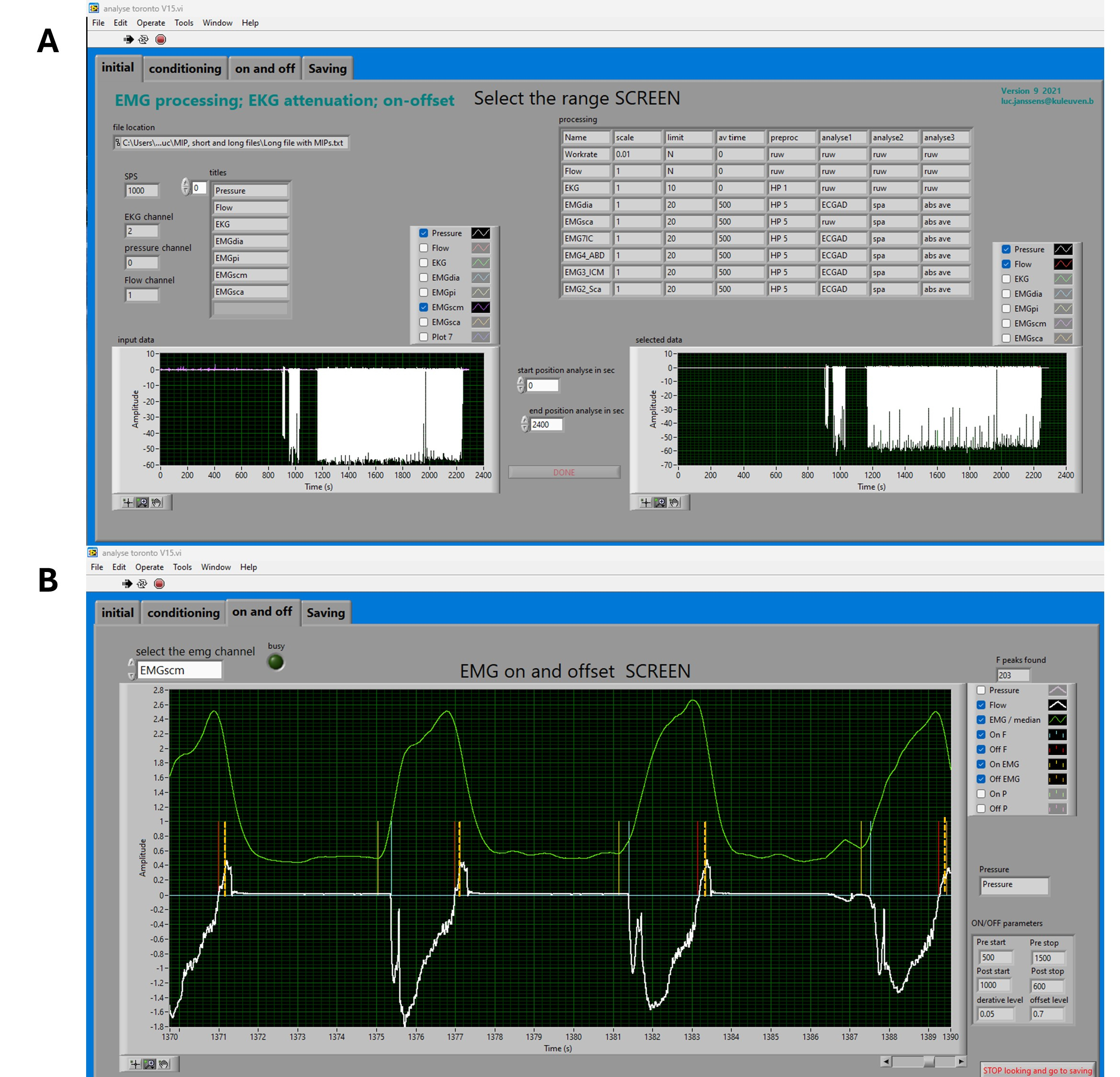Physiograph Attachments Rms Acquisition and Semi-Automated Analysis of Respiratory Muscle Surface ...