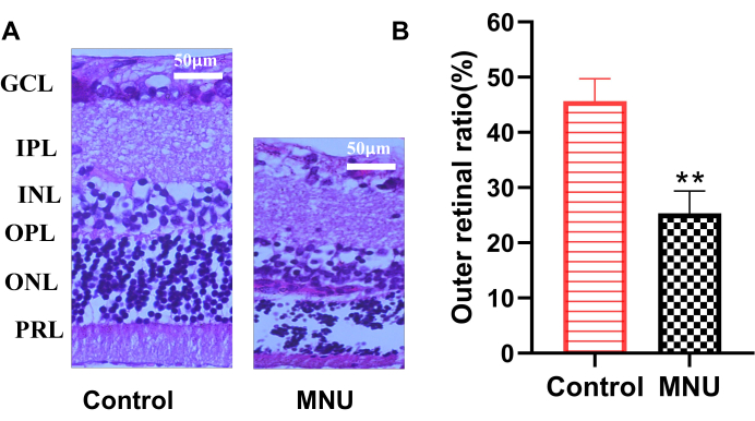 Retinal structure comparison, MNU vs. control; histology image and bar chart; neuron layer analysis.