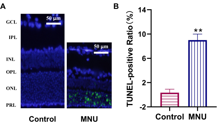 Fluorescent microscopy of retinal layers with TUNEL assay, bar graph showing apoptosis comparison.