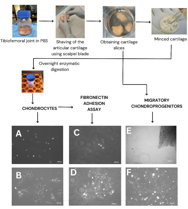 Tibiofemoral joint dissection, cartilage processing, enzymatic digestion, fibronectin assay diagram.
