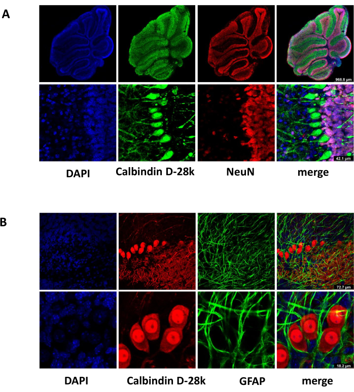 Fluorescence microscopy of cerebellum cells; DAPI, Calbindin D-28k, NeuN, GFAP.