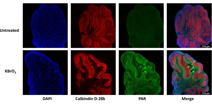 Immunofluorescence comparison: untreated vs. KBrO3; markers DAPI, Calbindin D-28k, PAR, merge.