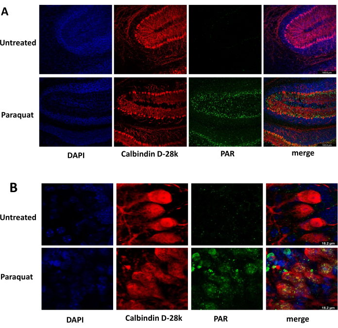 Fluorescence microscopy of DAPI, Calbindin D-28k, and PAR in untreated vs paraquat-treated cells.