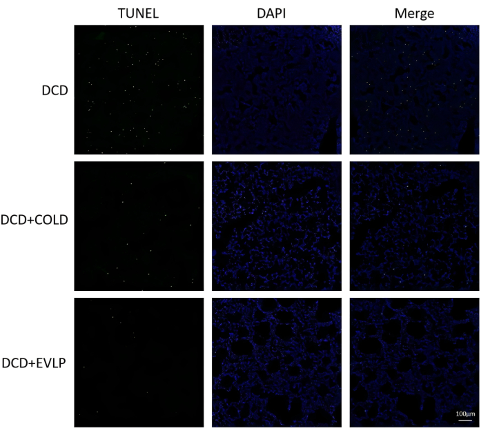 figure-results-6 TUNEL 检测示意图结合 DAPI 染色,比较 DCD、DCD+COLD、DCD+EVLP 条件。