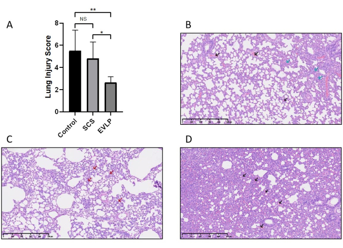figure-results-7 肺损伤评分柱状图与肺组织病理学分析,实验结果示意图。