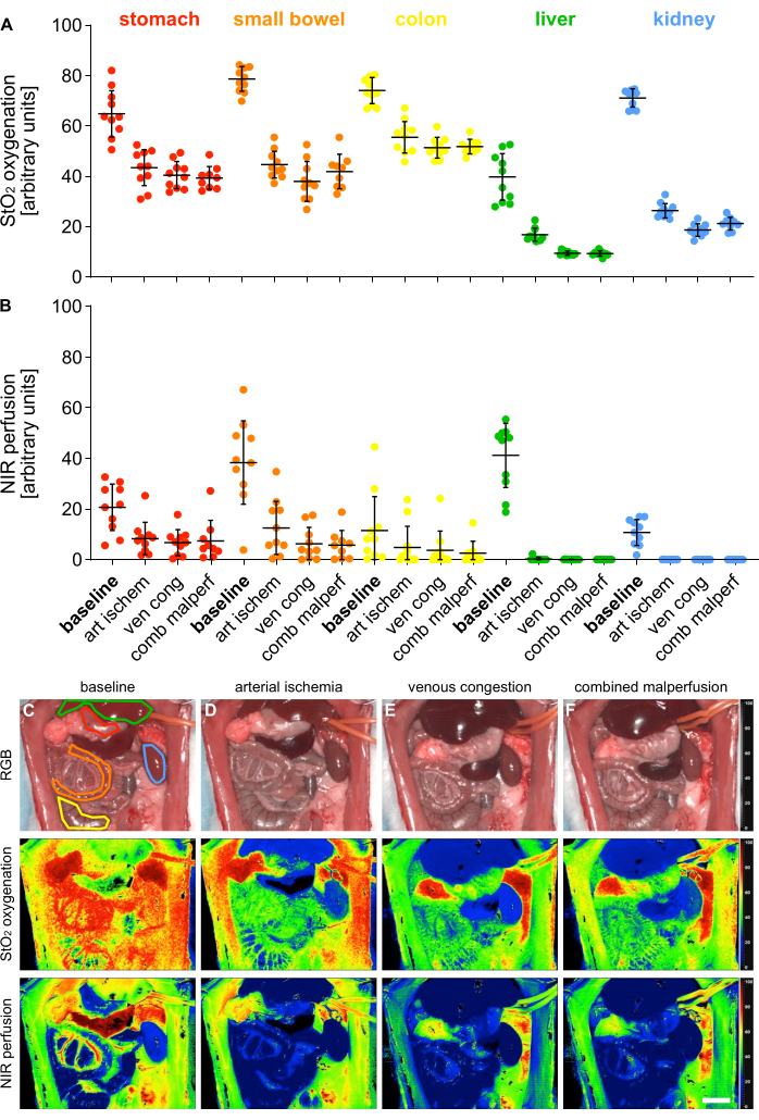 Organ oxygenation and perfusion charts, ischemia analysis, RGB and NIR imaging, scientific data.