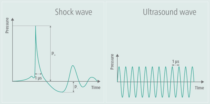 Shock and ultrasound wave comparison; pressure-time graph; research; wave dynamics study.