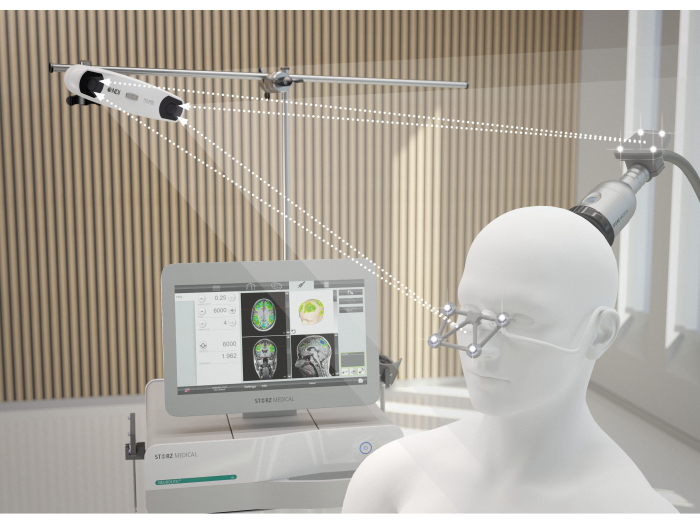 Neurosurgery guidance system diagram, showing navigation using imaging for precision brain surgery.