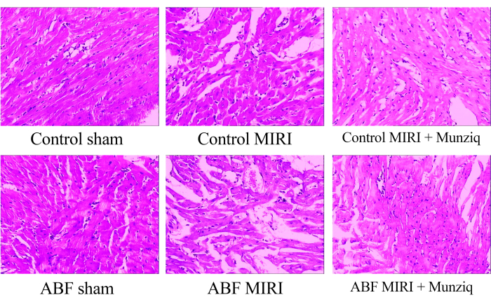 Herbal Munziq Ameliorates Myocardial Ischemia-Reperfusion Injury by ...