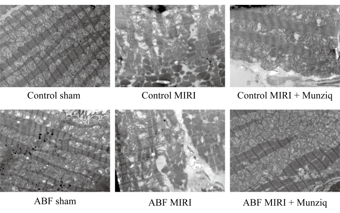 Herbal Munziq Ameliorates Myocardial Ischemia-Reperfusion Injury by ...