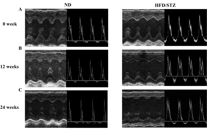 Ultrasound analysis; cardiac function comparison; ND vs. HFD/STZ; weeks 0, 12, 24; heart study chart.