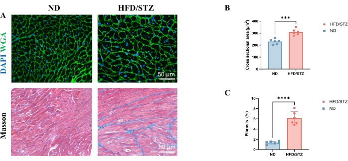 Histology comparison, ND vs HFD/STZ, muscle fibers; DAPI/WGA, Masson staining, bar graph results.