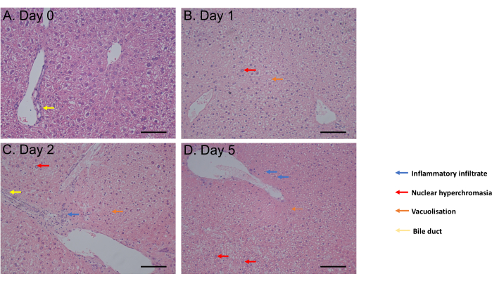 Liver tissue histopathology, diagram showing inflammation and changes from Day 0 to Day 5.