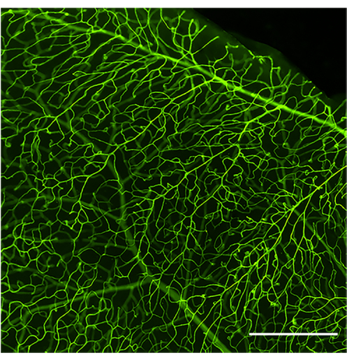 Fluorescence microscopy image; vascular network visualization; endothelial cells labeled with dye.