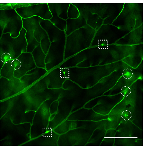 Microscopy image of vascular network; diagram shows fluorescence highlighting cellular structures.