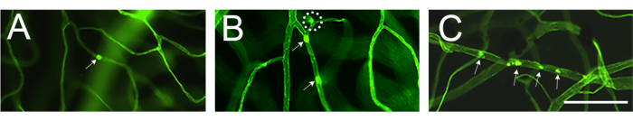 Confocal microscopy images; plant cell structure; fluorescence-tagged proteins; cellular detail.