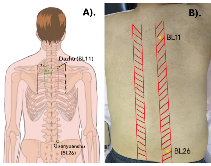 Acupuncture point diagram and human back photo showing Dazhu BL11 and Guanyuanshu BL26 locations.