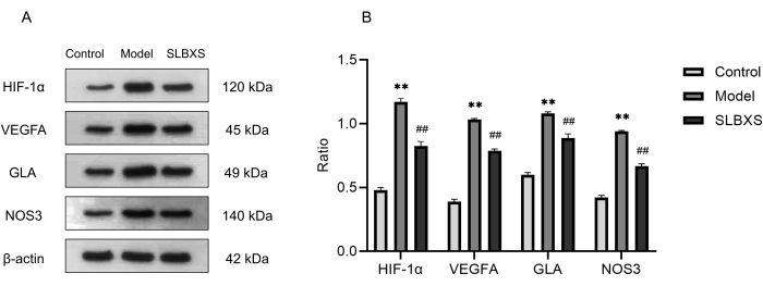 figure-results-5 Western blot analysis and bar graph of HIF-1α, VEGFA, GLA, NOS3 with control, model, SLBXS.