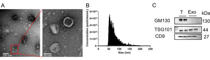 figure-results-5 Transmission electron microscopy of nanoparticles, size distribution graph, protein analysis gels.