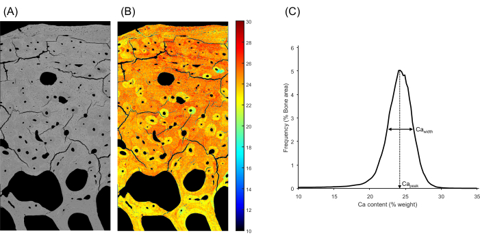 Bone mineral density analysis; grayscale and color maps with calcium content graph; quantitative study.
