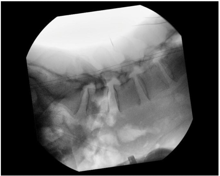 X-ray image of spinal vertebrae, showcasing bone structure, used in medical diagnostics and research.