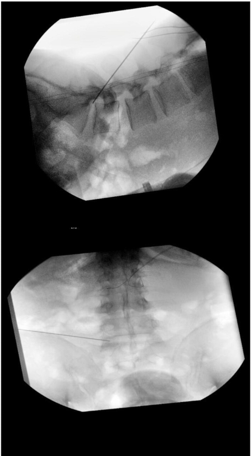Spinal x-ray showing vertebrae alignment; diagnostic imaging for medical analysis.