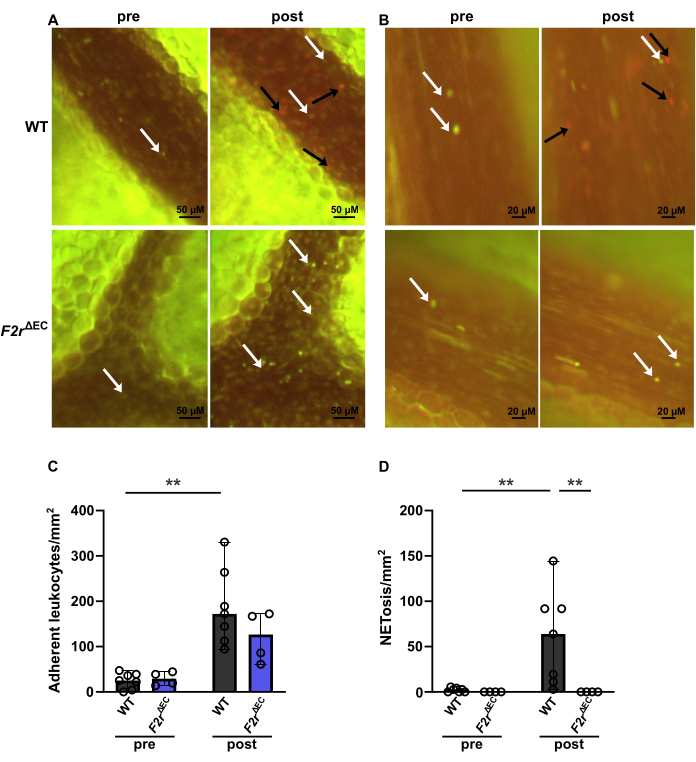 Leukocyte adhesion and NETosis analysis; microscopy, bar graphs display data pre and post conditions.