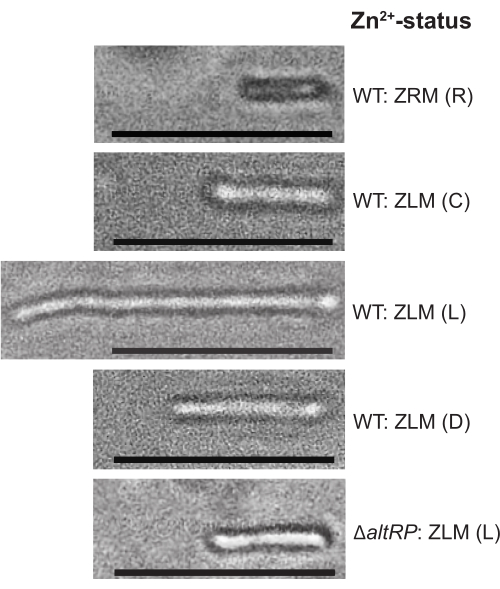 figure-results-2 Risultati dell'elettroforesi in funzione dello stato di Zn²⁺, WT vs ΔaltRP, analisi della separazione proteica.