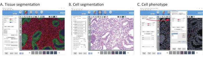 figure-results-4 Tissue, cell segmentation, and phenotype analysis software interface; image processing workflow.