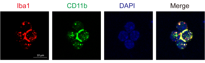 figure-results-4 Fluorescence microscopy, Iba1 CD11b DAPI markers, cell imaging, immunofluorescence analysis.