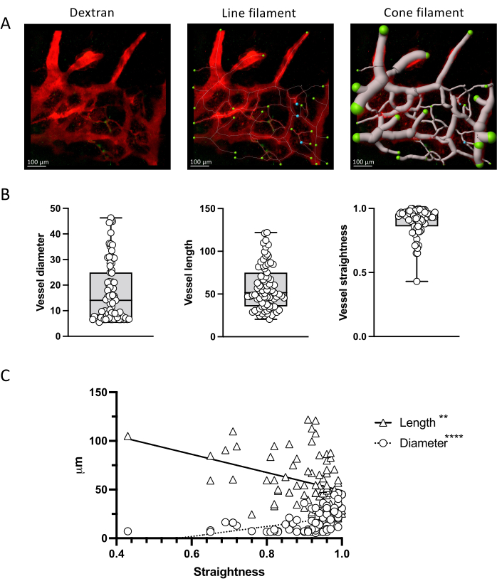 figure-results-4 Vascular analysis with dextran, line, and cone filaments; includes vessel diameter, length, straightness charts.