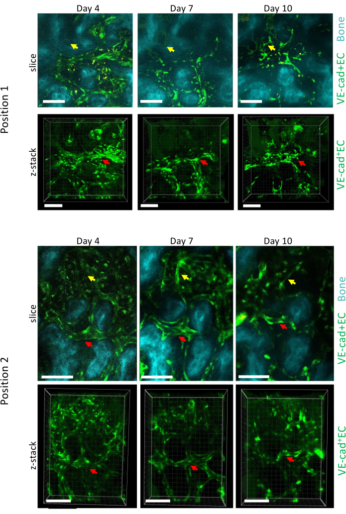 figure-results-5 VE-cadherin expression in bone, z-stack microscopy, days 4-10, cellular organization analysis.