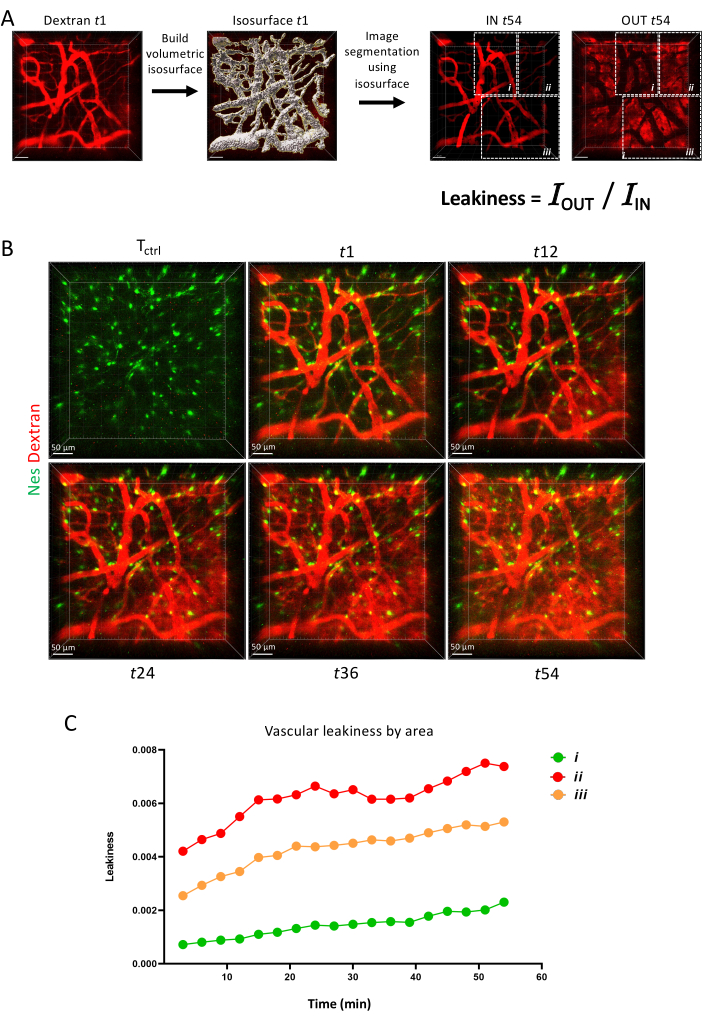 figure-results-6 Vascular leakiness analysis; microscopy image, segmentation, leaky vessels; chart tracks leaky index.