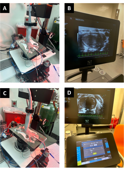 Ultrasound stability test setup with mechanical stress, monitor images, and control interface.