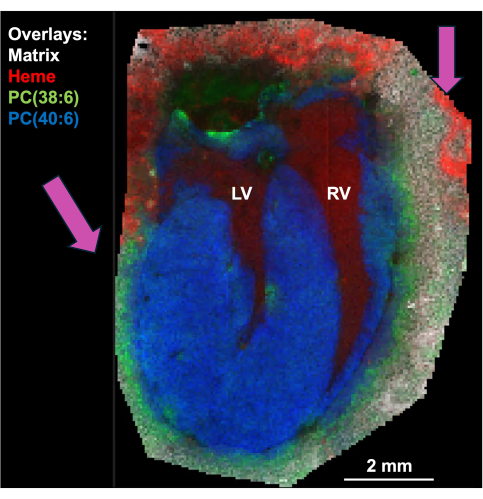 Mass spectrometry imaging of heart tissue, showing heme and phosphatidylcholine distribution (diagram).