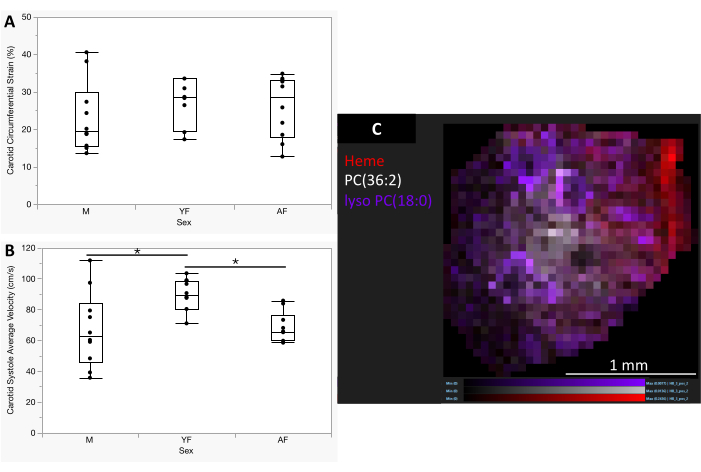 Carotid strain and velocity box plots; heme distribution heatmap; sex comparison in ultrasound imaging.