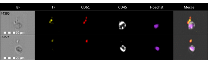 figure-results-7 Fluorescence microscopy, cell markers TF, CD61, CD45; stained; diagram; protein localization.